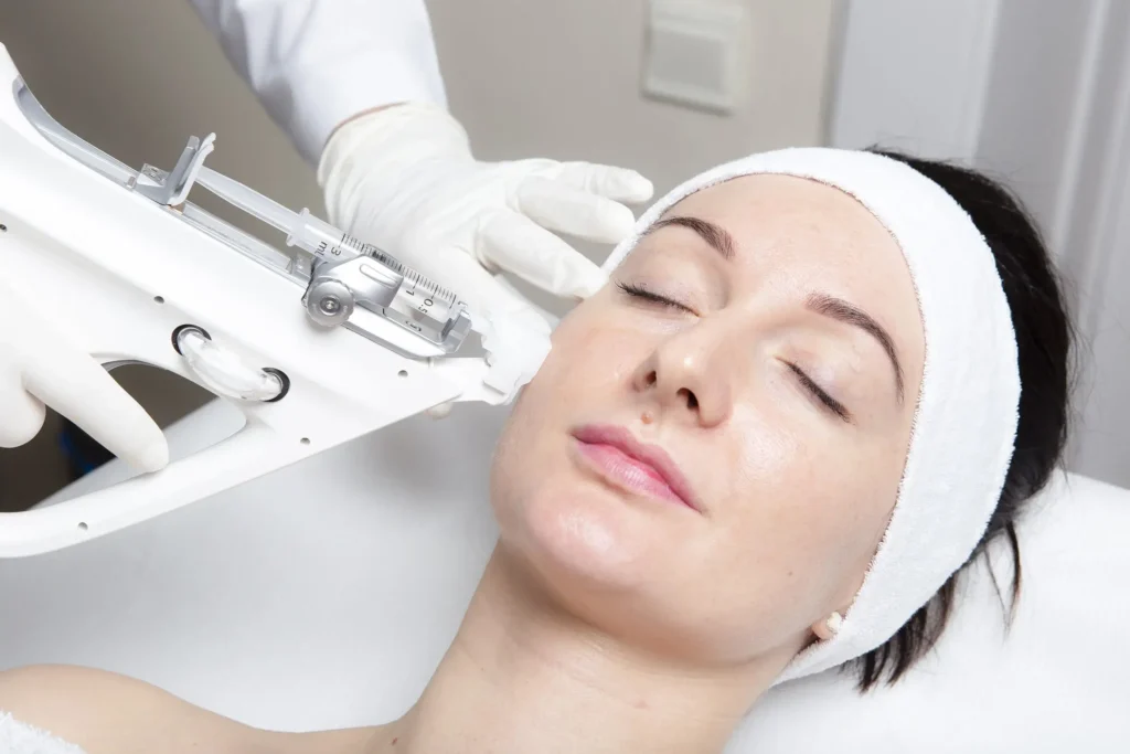 Rewolucyjna mezoterapia próżniowa Vital Injector – skutecznie, bez bólu, bez siniaków